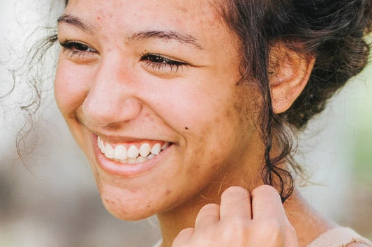 Top Five Products for Scar Reduction